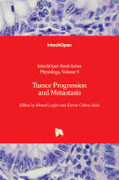 Tumor Progression and Metastasis