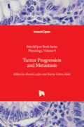 Tumor Progression and Metastasis